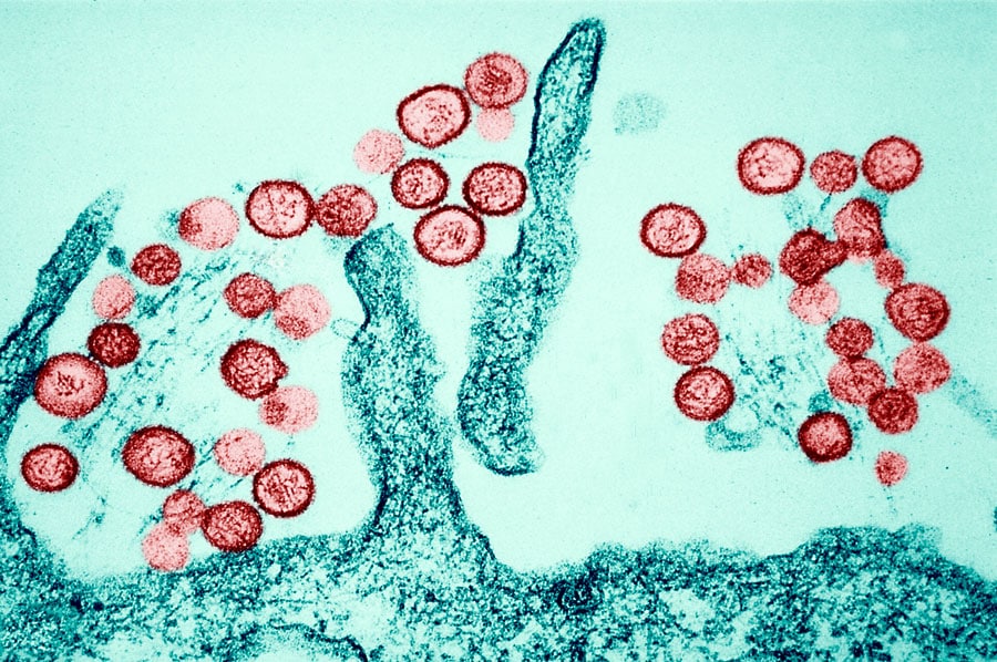 Closeup of Hantavirus Cells Under a Microscope