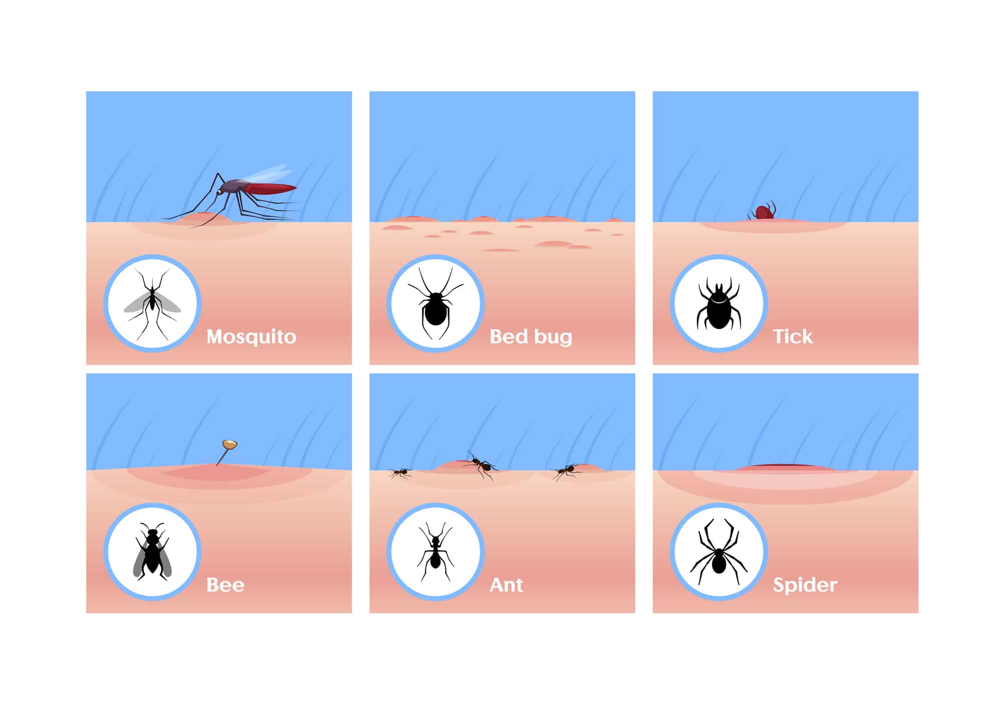 graphic showing different bug bites