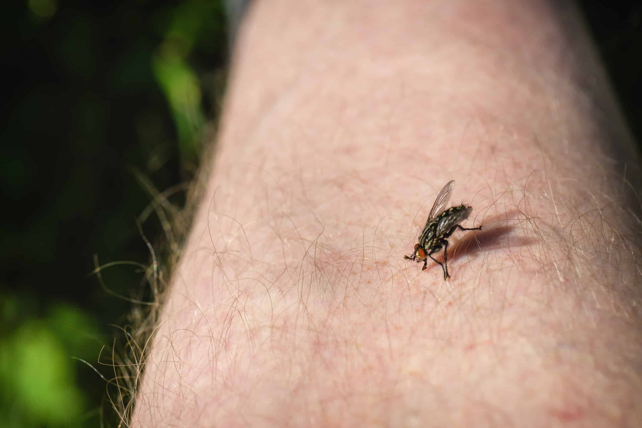 A fly with black and yellow markings lands on human skin covered in fine hair